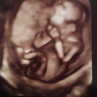Babylist Registry Photo.