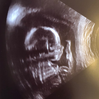Babylist Registry Photo.
