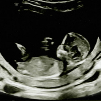 Babylist Registry Photo.