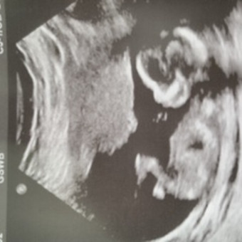 Babylist Registry Photo.