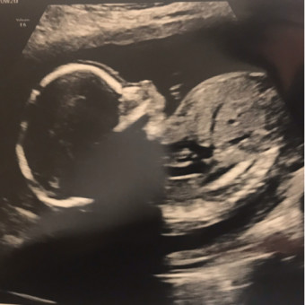 Babylist Registry Photo.