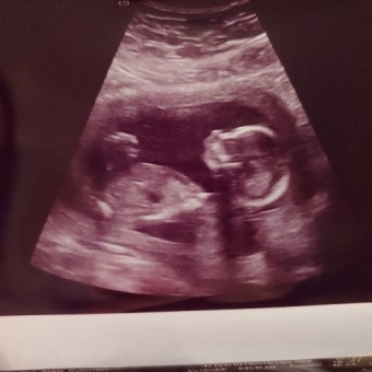 Babylist Registry Photo.