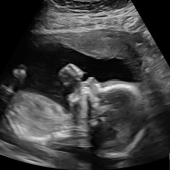 Babylist Registry Photo.