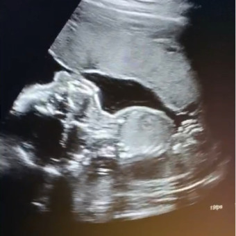 Babylist Registry Photo.
