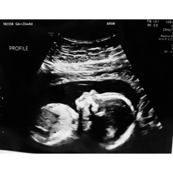Babylist Registry Photo.