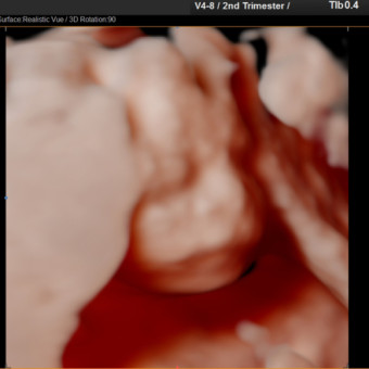 Babylist Registry Photo.