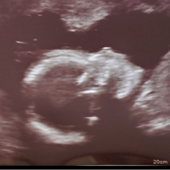Babylist Registry Photo.