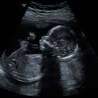 Babylist Registry Photo.