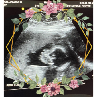 Babylist Registry Photo.