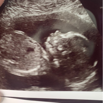 Babylist Registry Photo.