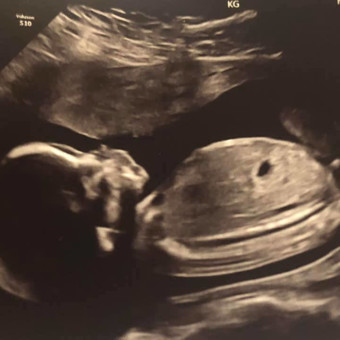 Babylist Registry Photo.