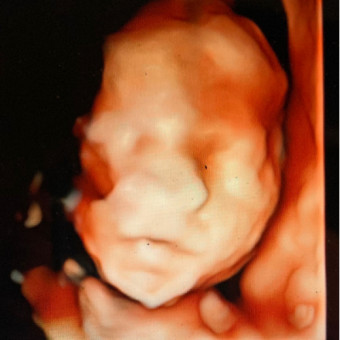 Babylist Registry Photo.