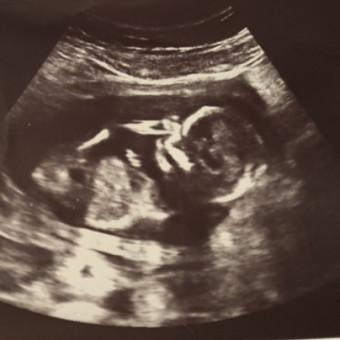 Babylist Registry Photo.