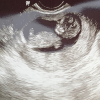 Babylist Registry Photo.