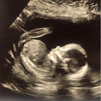 Babylist Registry Photo.
