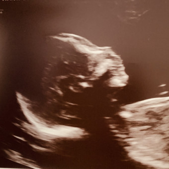 Babylist Registry Photo.