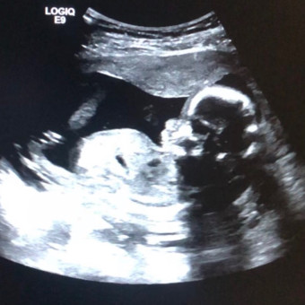 Babylist Registry Photo.