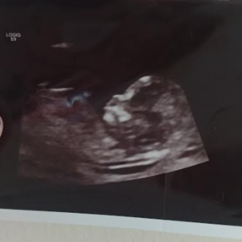 Babylist Registry Photo.