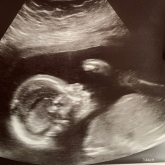 Babylist Registry Photo.