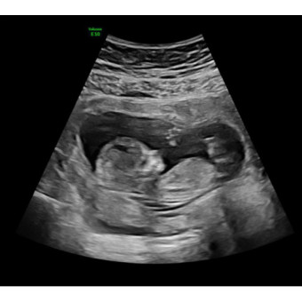 Babylist Registry Photo.