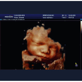 Babylist Registry Photo.