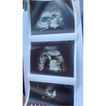 Babylist Registry Photo.