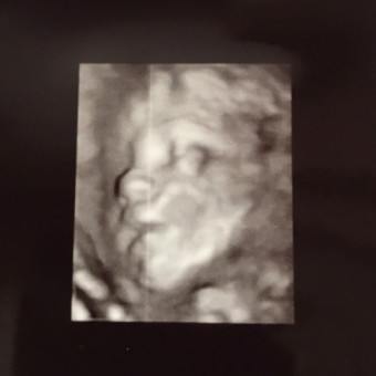 Babylist Registry Photo.