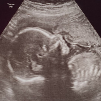 Babylist Registry Photo.