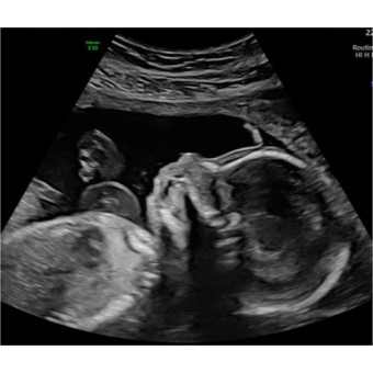Babylist Registry Photo.
