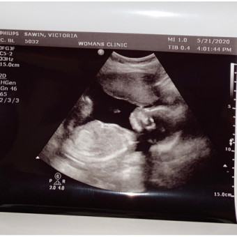 Babylist Registry Photo.