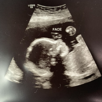 Babylist Registry Photo.
