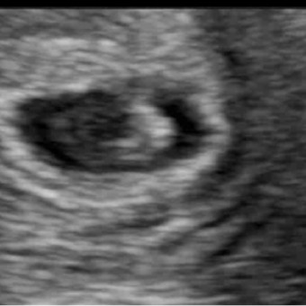 Babylist Registry Photo.