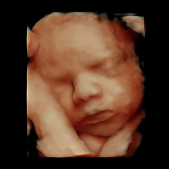 Babylist Registry Photo.