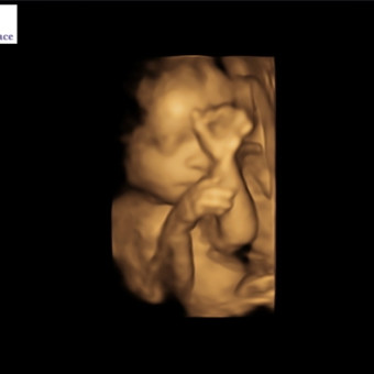 Babylist Registry Photo.
