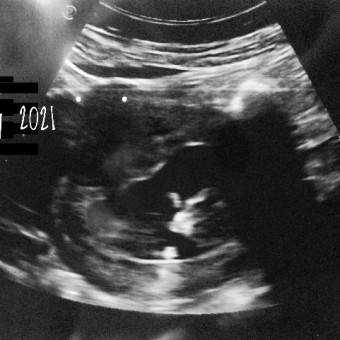Babylist Registry Photo.
