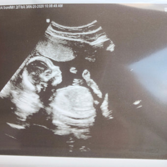 Babylist Registry Photo.