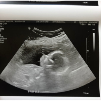 Babylist Registry Photo.