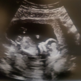 Babylist Registry Photo.