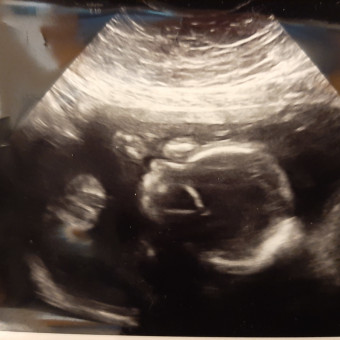 Babylist Registry Photo.
