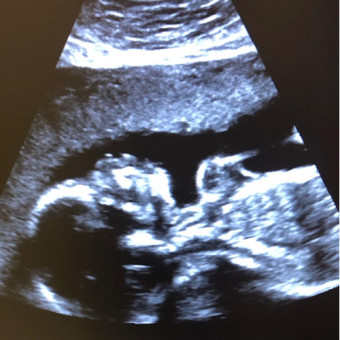 Babylist Registry Photo.