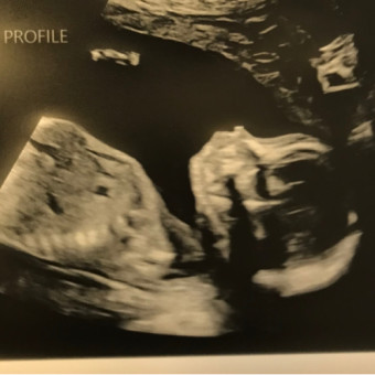 Babylist Registry Photo.
