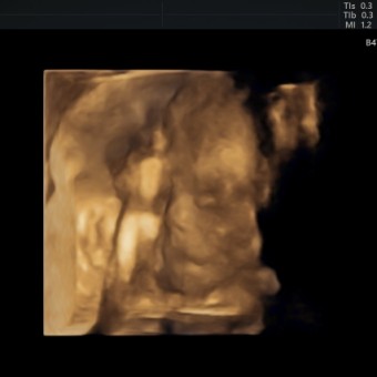 Babylist Registry Photo.