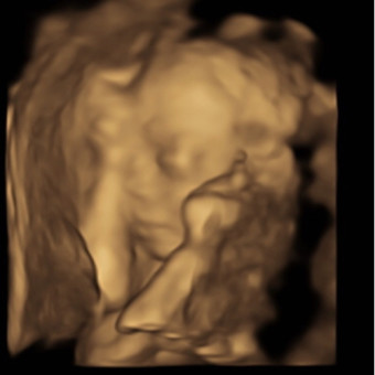 Babylist Registry Photo.