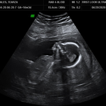 Babylist Registry Photo.