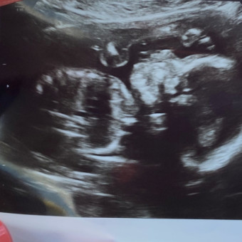 Babylist Registry Photo.