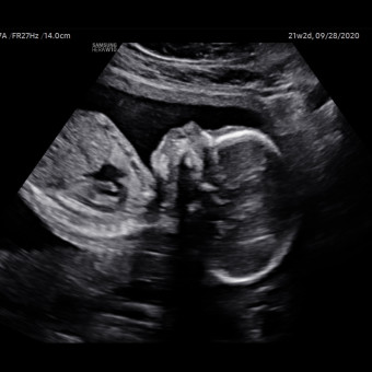 Babylist Registry Photo.