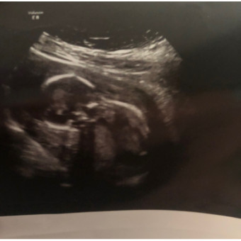 Babylist Registry Photo.