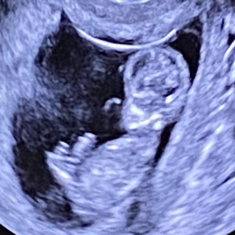 Babylist Registry Photo.