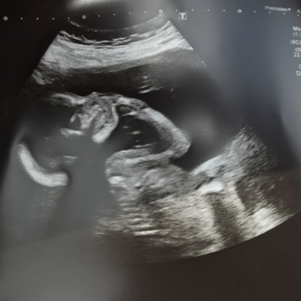 Babylist Registry Photo.