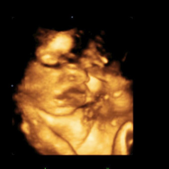 Babylist Registry Photo.